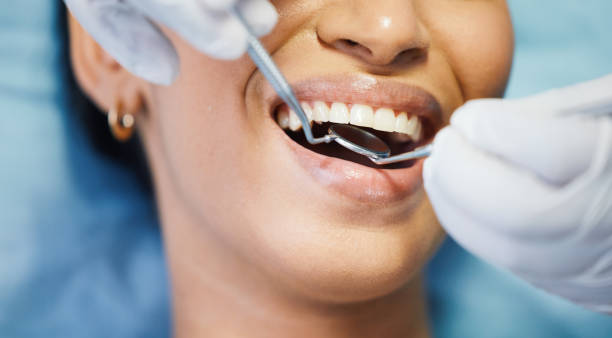 Best Emergency Gum Treatment in Franklin Square, NY